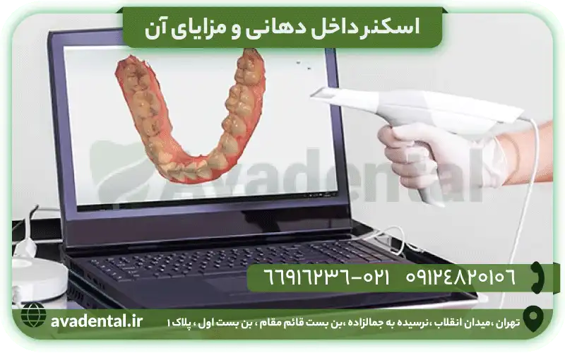 اسکنر داخل دهانی چیست؟