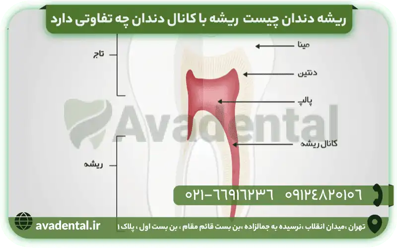 ریشه دندان چیست؟