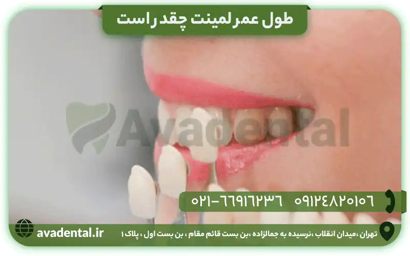طول عمر لمینت چقدر است