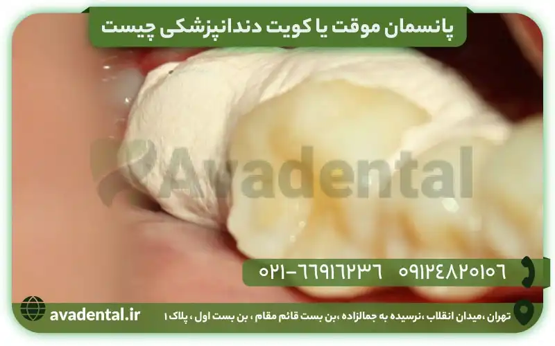 کویت دندانپزشکی
