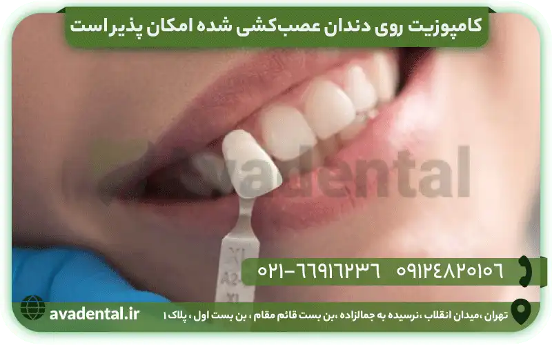 کامپوزیت روی دندان عصب کشی شده