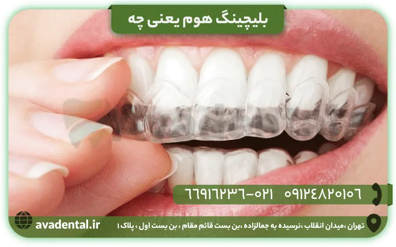 بلیچینگ هوم یعنی چه