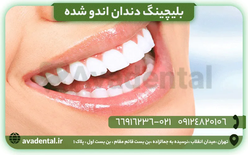 اندو بلیچینگ 8 اندو بلیچینگ